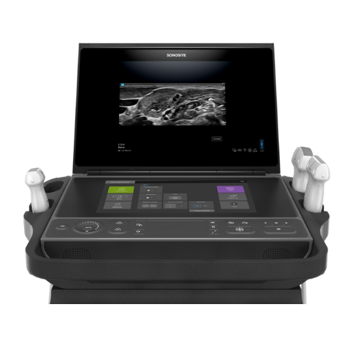 MSK scanning nemt med Sonosite ZX