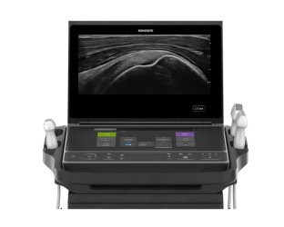 Sonosite ZX for MSK-skanningsenheter