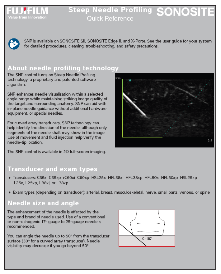 SNP Sonosite user guide