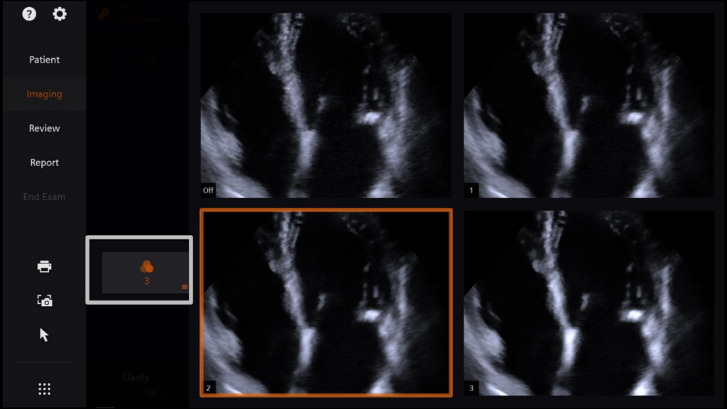 clear2-siemens-healthineers-us-acuson-origin-ultraart-clinical-image