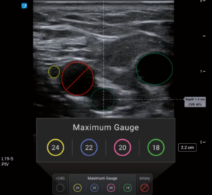 PIV Assist Software