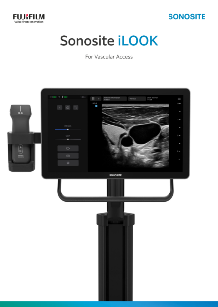 Sonosite iLOOK Product Brochure