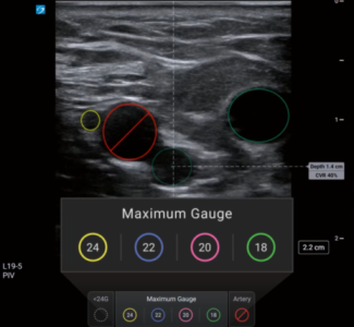 PIV Assist Software