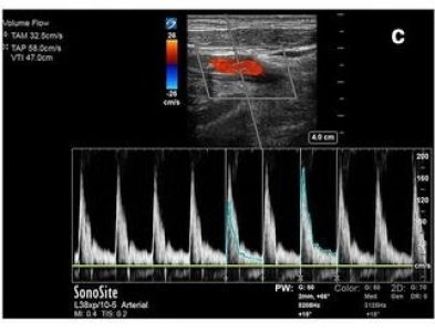 Transcranial Doppler (TCD) icon
